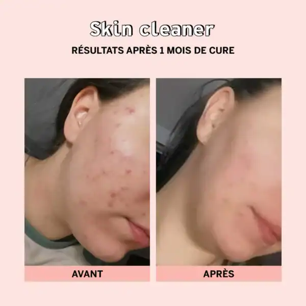 Skin cleaner | Gélules – Image 4