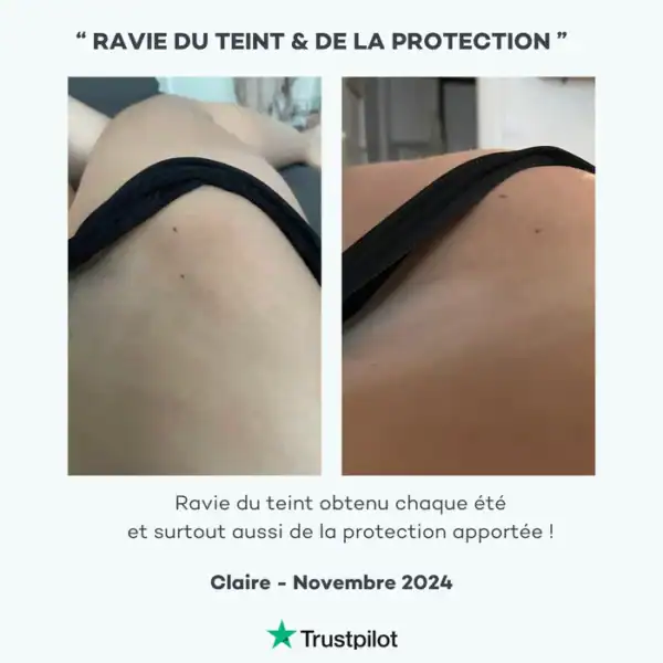 Absolu de Mélanine – Image 4